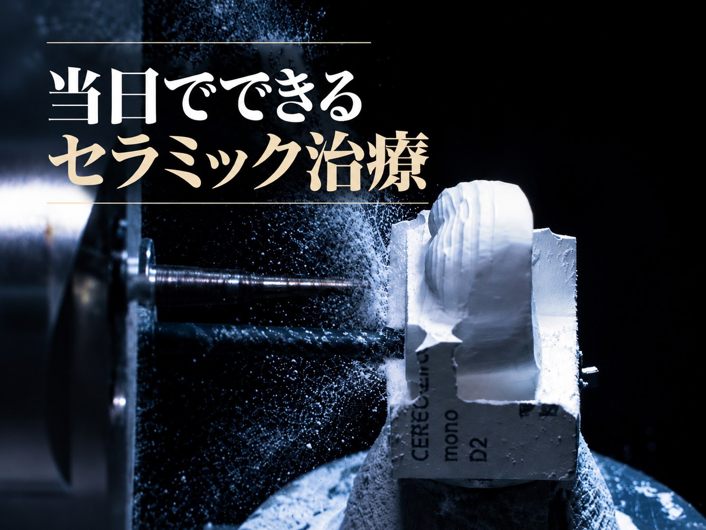 即日治療のために院内でセラミッククラウンを削り出している様子（ソウルのARC Dental 口腔顎顔面外科）